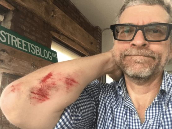 Kuntzman shows off his Flushing Avenue tattoo. Photo: Streetsblog