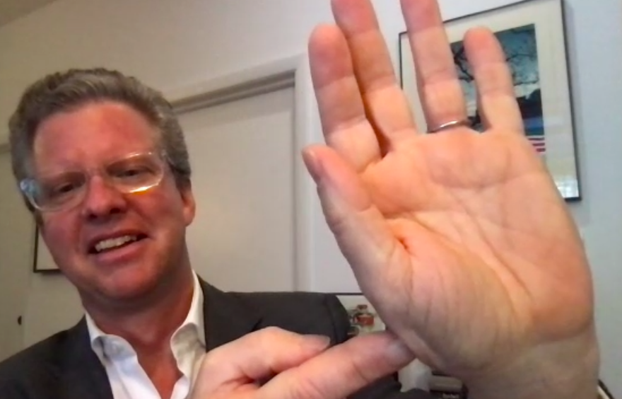 Mayoral candidate Shaun Donovan is a regular cyclist — and has the wounds to prove it. Here he is showing the remnants of an Obama-era crash in D.C.